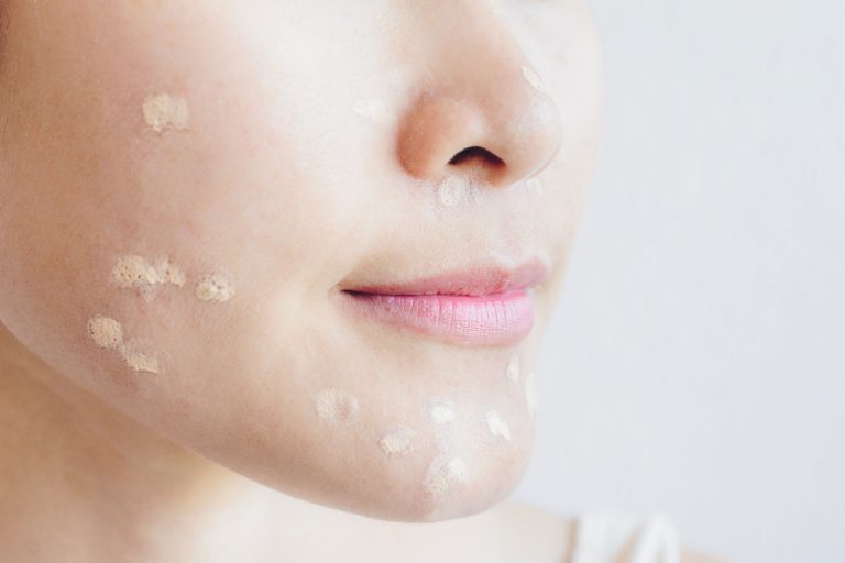A woman putting face moisturizer on her face, How To Use Tretinoin Cream With Moisturizer