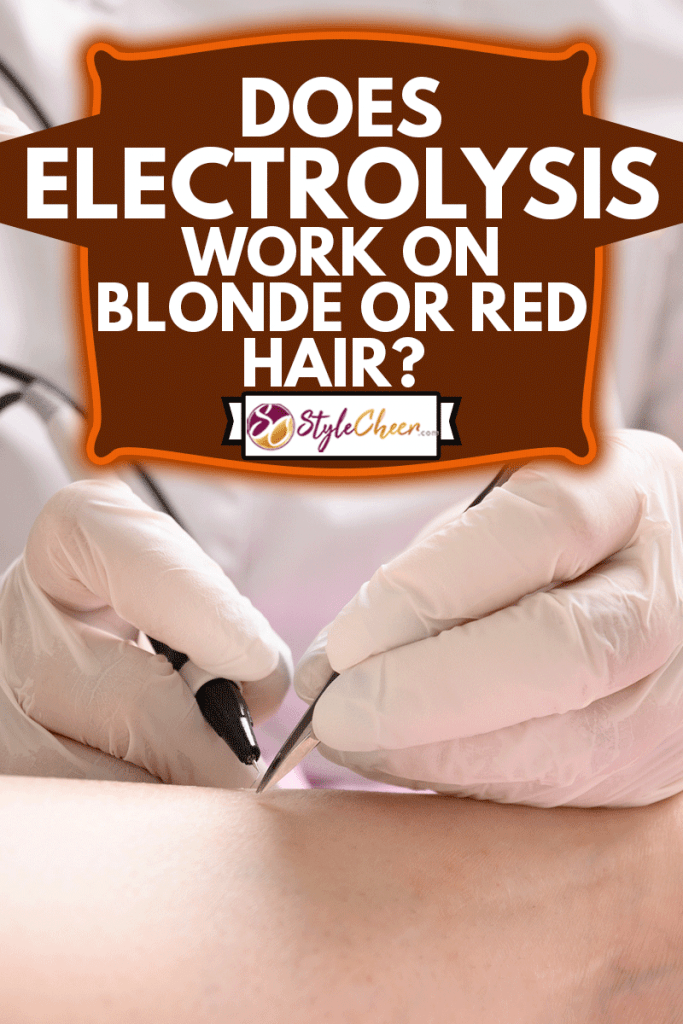 Removal hair from womans legs by electro epilation method, Does Electrolysis Work On Blonde Or Red Hair?