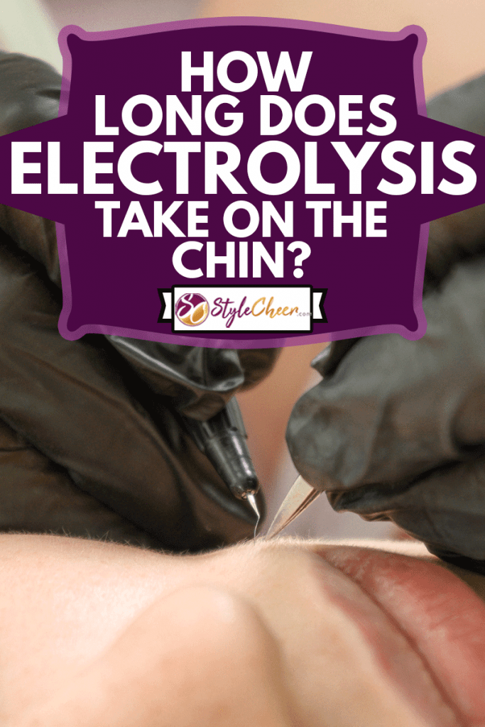 Removal of facial hair of a woman using electrolysis, How Long Does Electrolysis Take On The Chin?